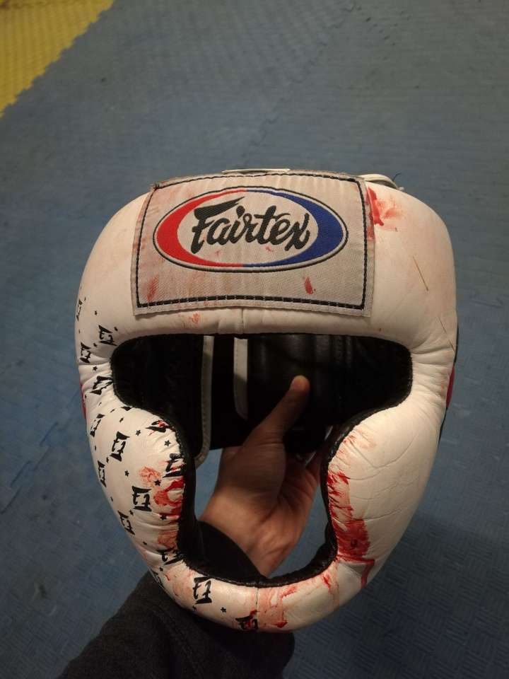 你们在学习拳击或者其他格斗术的过程中都受过哪些伤?