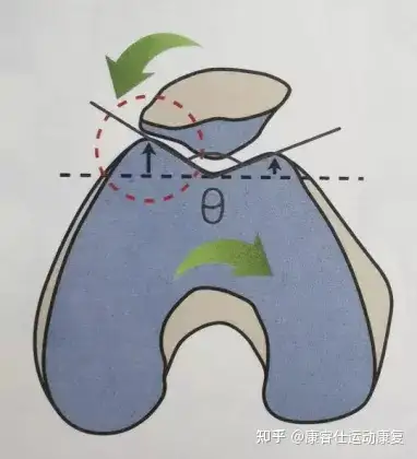2,q角与女性膝痛