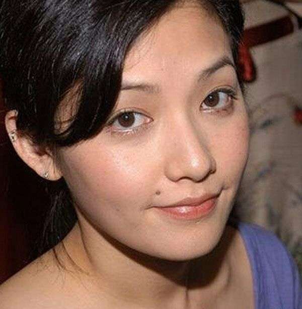 嘴角痣 媒婆痣 不知道到底取还是不取!? - 知乎