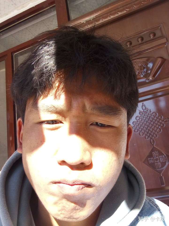 男生长得丑还留长发是什么体验?