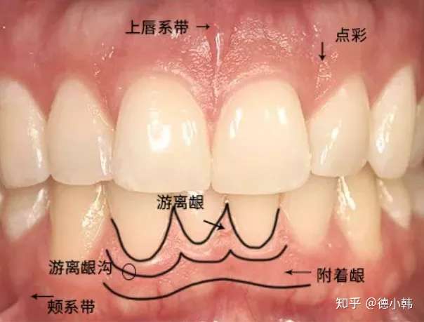 请问我的牙龈为什么会发黑?有图? 