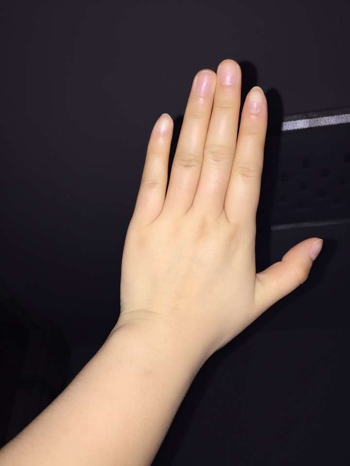 手胖是一种怎样的体验?