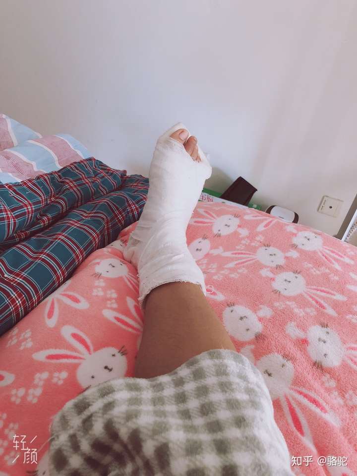 大拇脚趾头骨折如何快速恢复