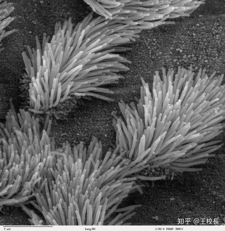 人体呼吸道上的纤毛