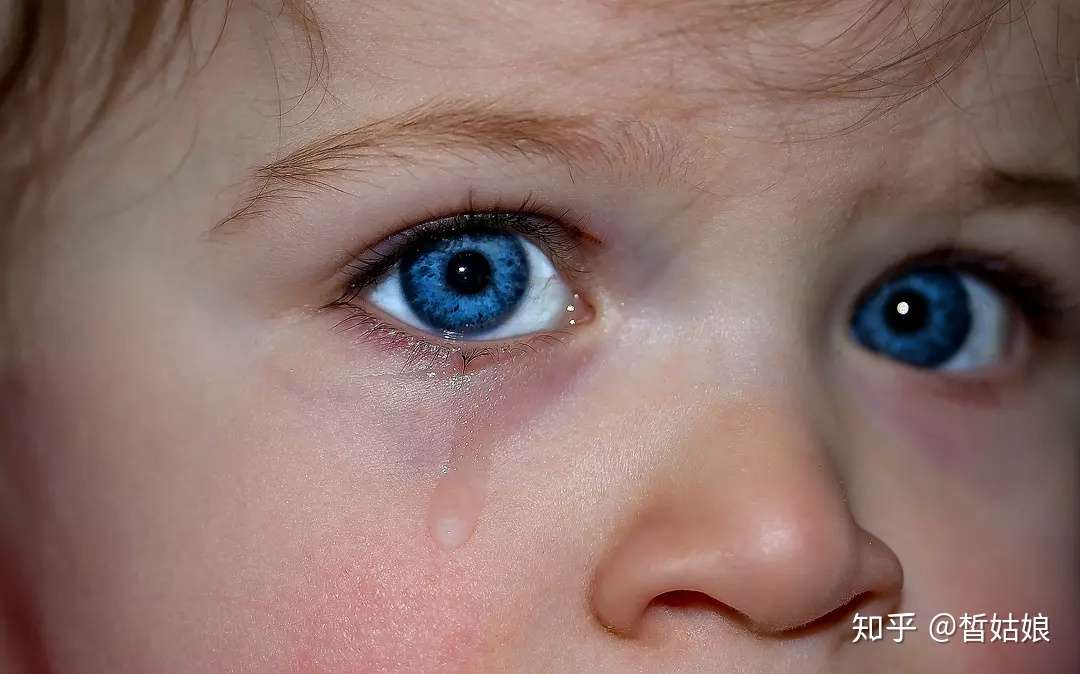 孩子爱揉眼睛 经常流泪 可能是倒睫在作怪 知乎