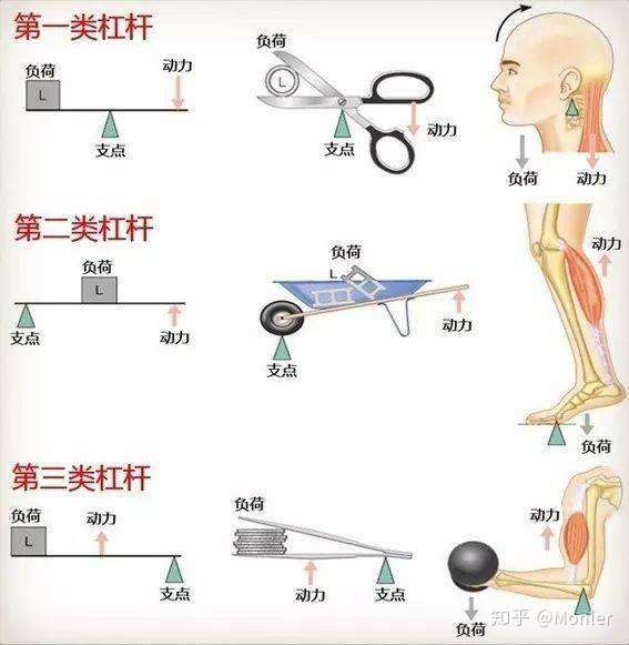 解释杠杆原理在康复医学中的应用
