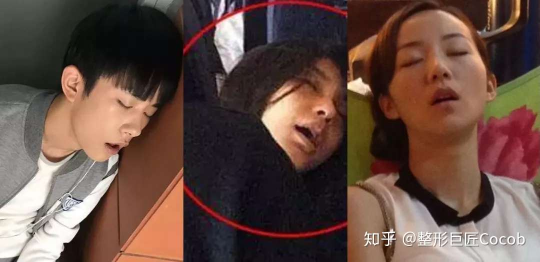 还在怪口式呼吸 花式闭嘴拯救不了龇牙突嘴 知乎