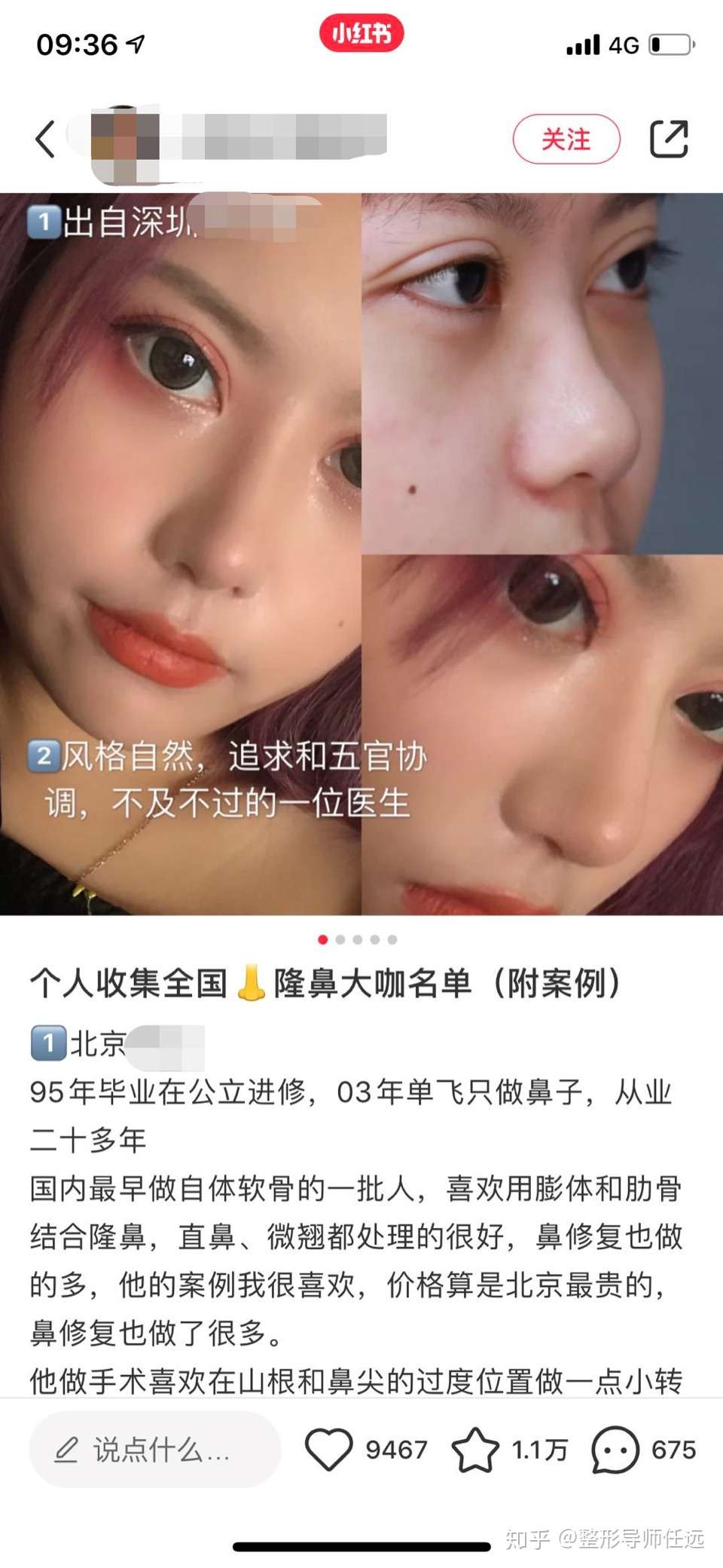 整形效果不满意该怎么办 知乎