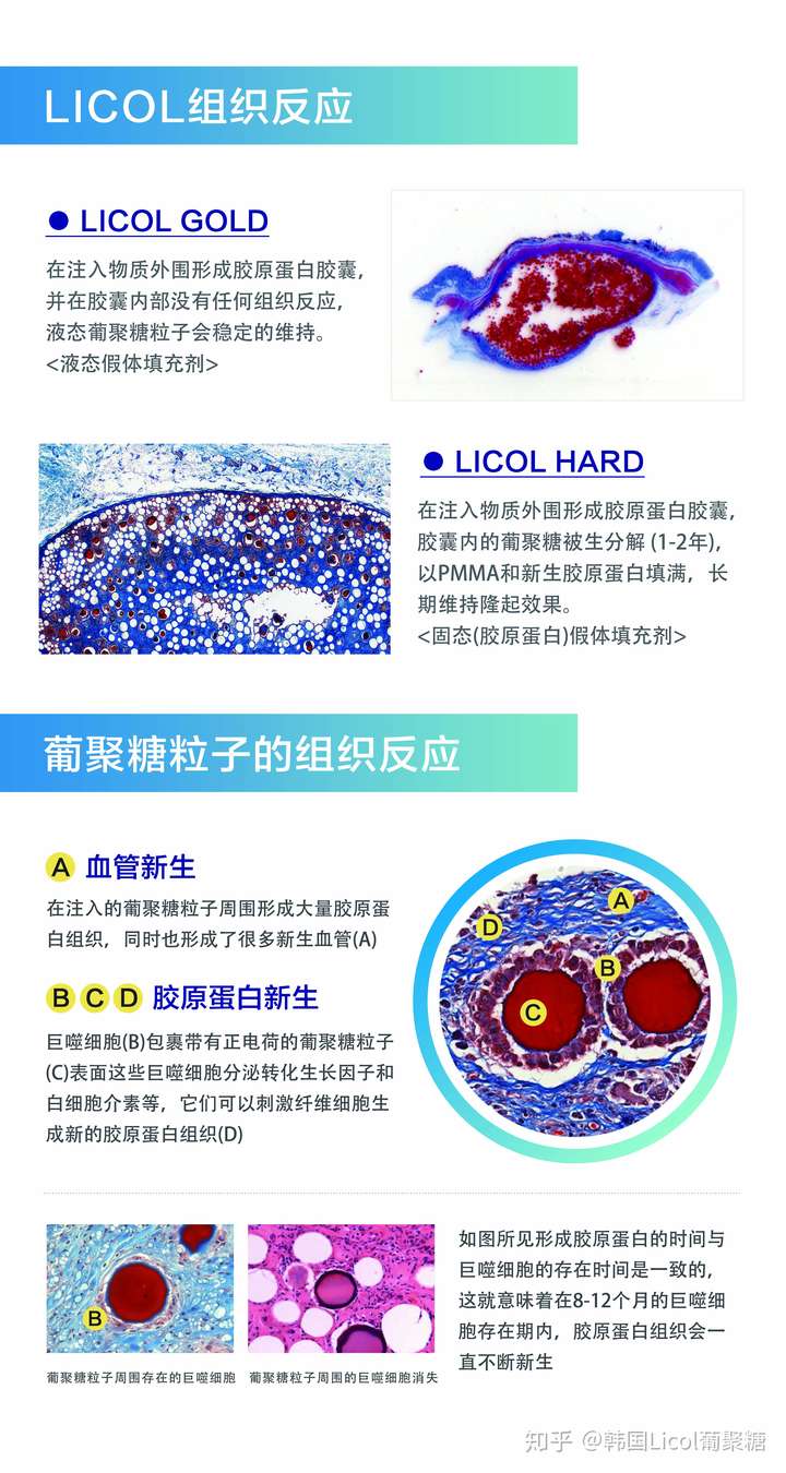 葡聚糖填充是什么鬼