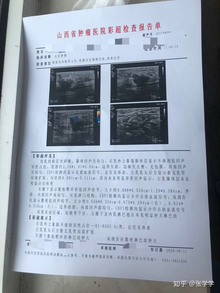 浸润性乳腺癌治疗到出院全过程
