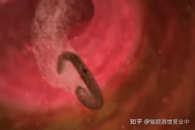 你的肚子里有多少蛔虫 寄生虫病有多可怕 知乎