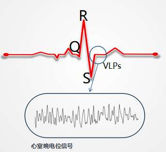 猝死/过劳死有没有先兆?