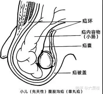 宝宝的蛋蛋上出现这2种情况一定要尽早看医生
