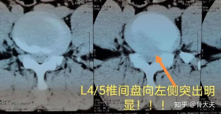 非遗岩鹰拳教学视频（岩鹰拳王） 第3张