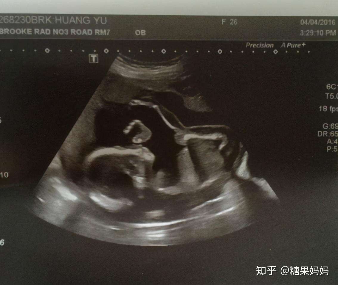 孕期这几种反应 证明孕妈怀了个 机灵鬼 将来多半是个小学霸 知乎