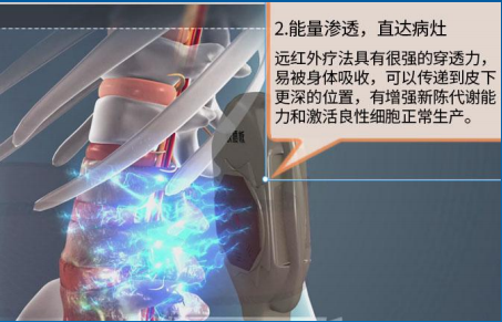 铁腰板治疗仪