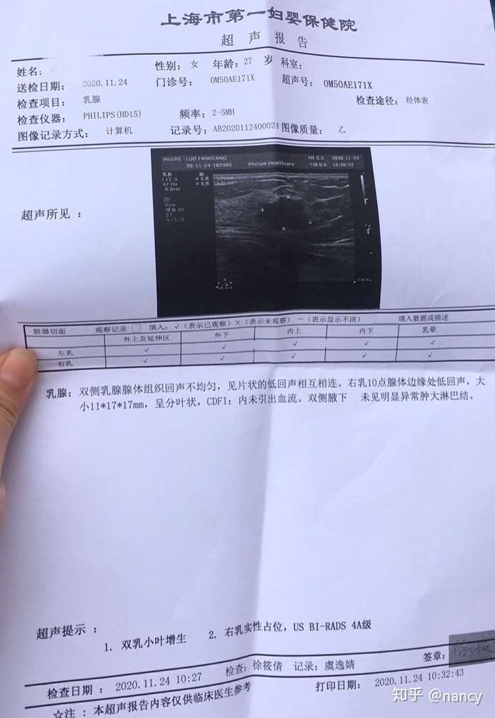 乳腺b超显示usbirads4a级要不要立马手术