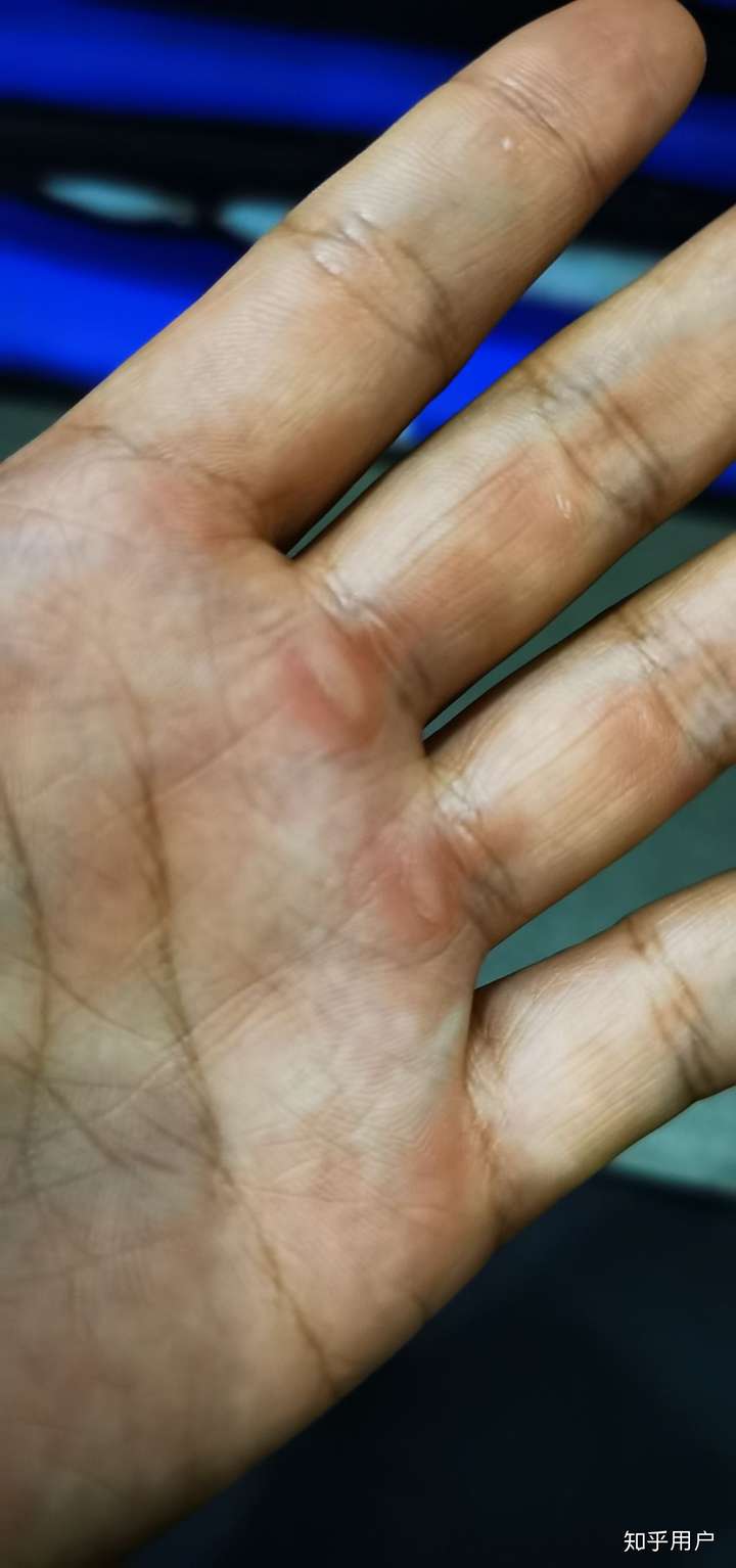 那些身材很好的健身妹子们,撸铁的女孩子们,也是一手的茧子吗?