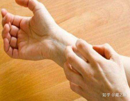 皮肤有这四个变化，很可能是糖尿病的征兆，赶紧自检一下- 知乎