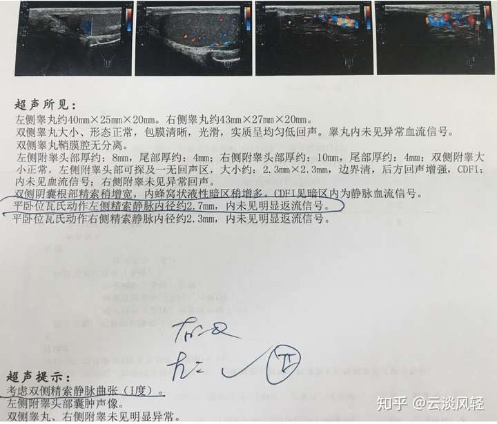 終於懷孕分享少弱畸精及精索靜脈曲張不育治療之路的點滴經驗希望可以