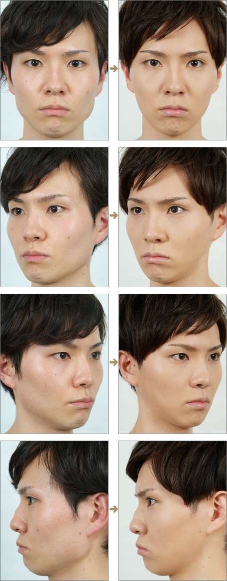 听说日本也有很多女星整容 为什么看起来日本女星整容比韩国的自然很多 但是好像国内很少有人去日本整容 知乎 听说日本也有很多女星整容 为什么看起来日本女星整容比韩国的自然很多 但是好像国内很少有人去日本整容 知乎