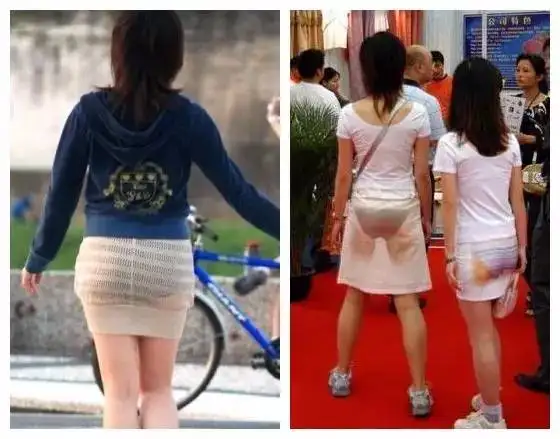 勒痕明显夏天一不小心,就会遭遇尴尬的事情.