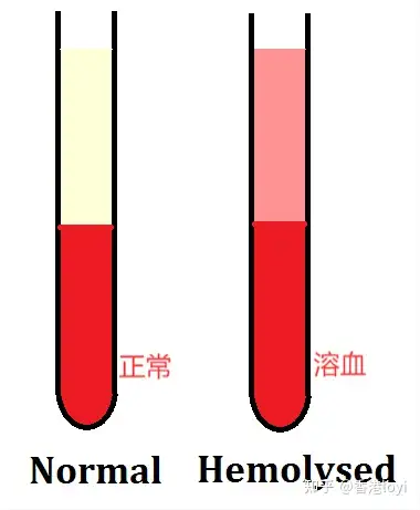 溶血样本图片