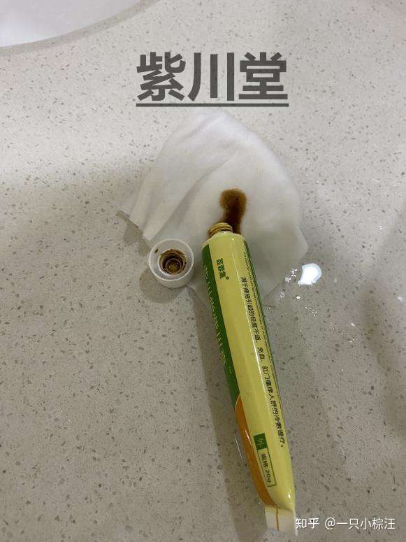 為什麼會長痔瘡痔瘡的病因有哪些