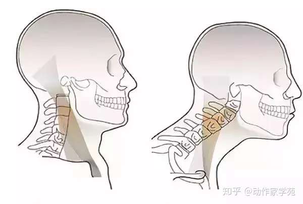 浅谈胸锁乳突肌 知乎