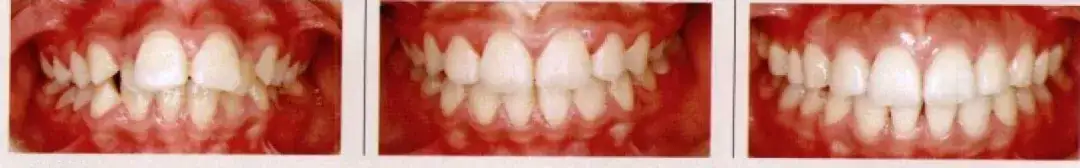 小时候很好看 你的颜值是怎么一步步垮掉的 知乎