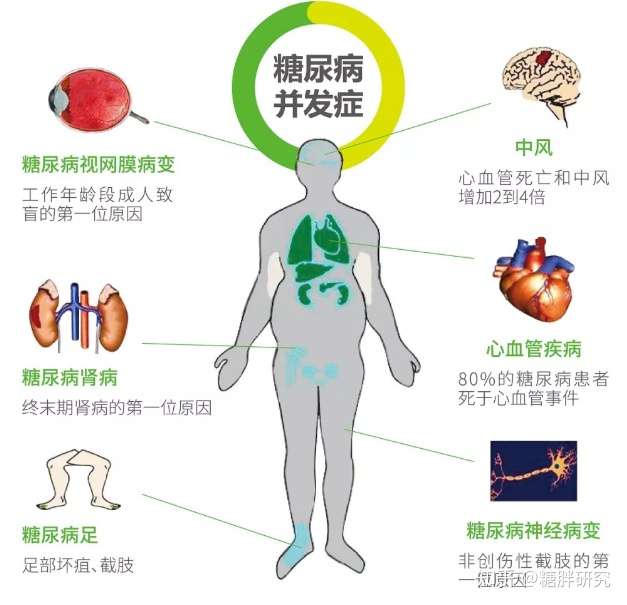 糖尿病并发症到了哪种程度 一看便知 知乎