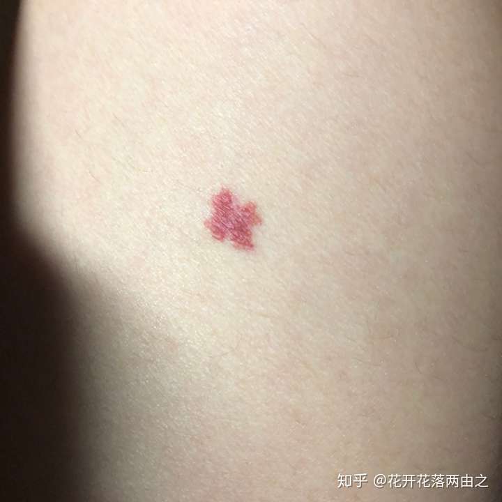 大家的胎记都长在什么地方?
