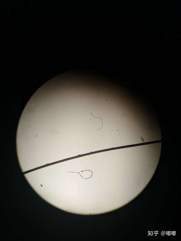 以及不明彩色线形东西 蚊子头,腿,肚子,以及小飞虫翅膀 显微镜下的盐