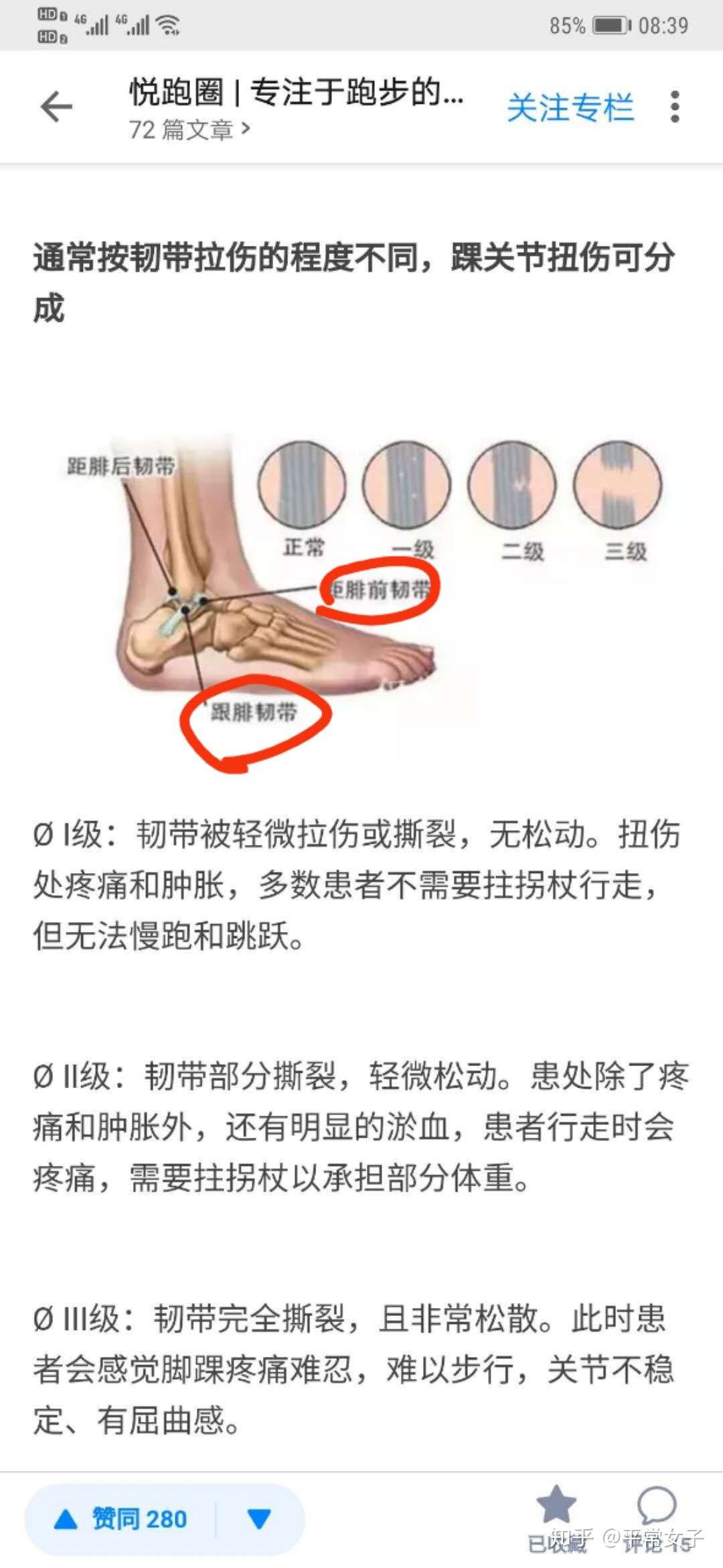 脚踝扭伤恢复过程 知乎