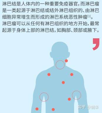 局部症状无痛性进行性淋巴结肿大,肿大淋巴结压迫周围组织器官出现