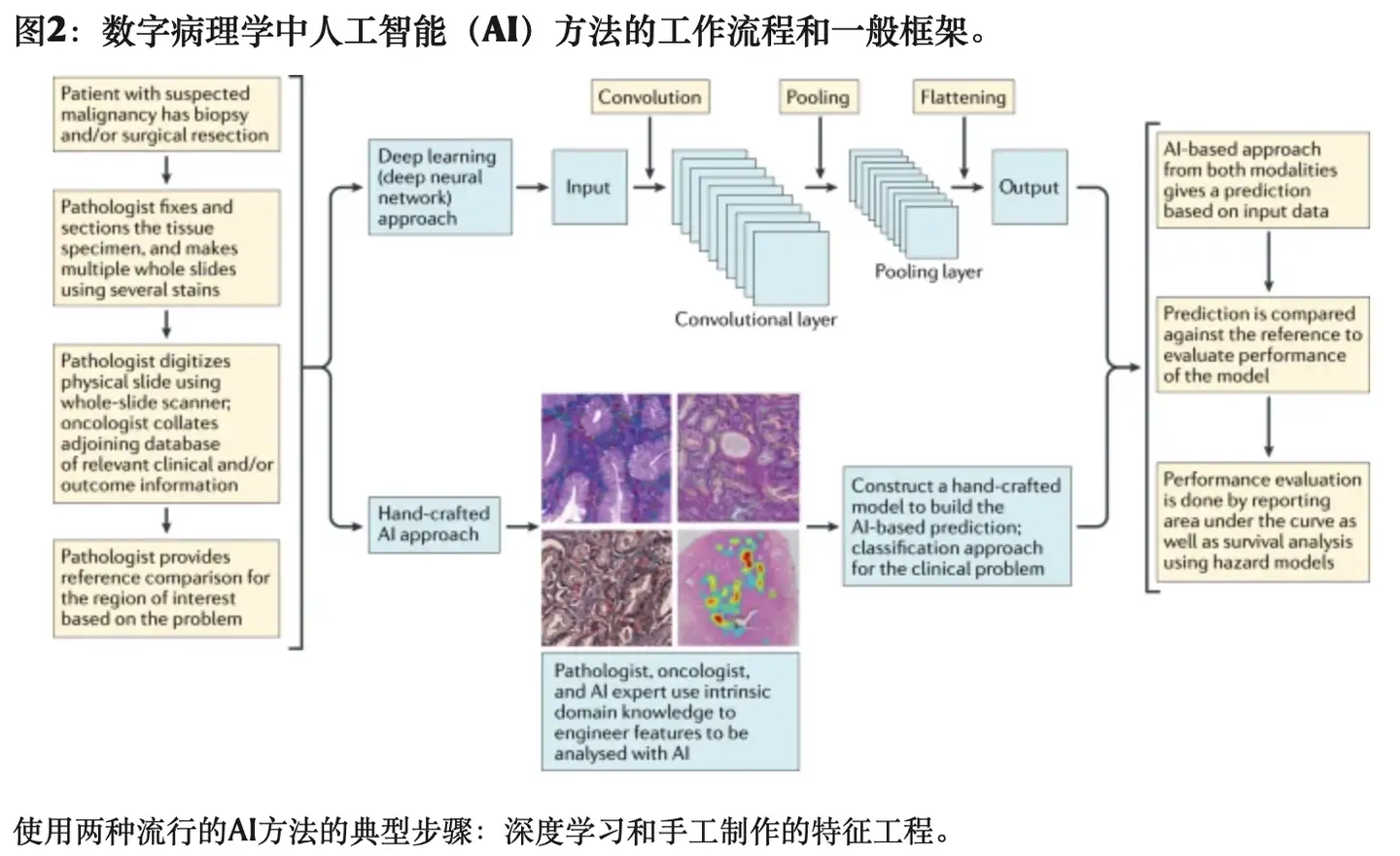 论文翻译: 数字病理学中的人工智能— 用于诊断和精确肿瘤学的新工具- 知乎