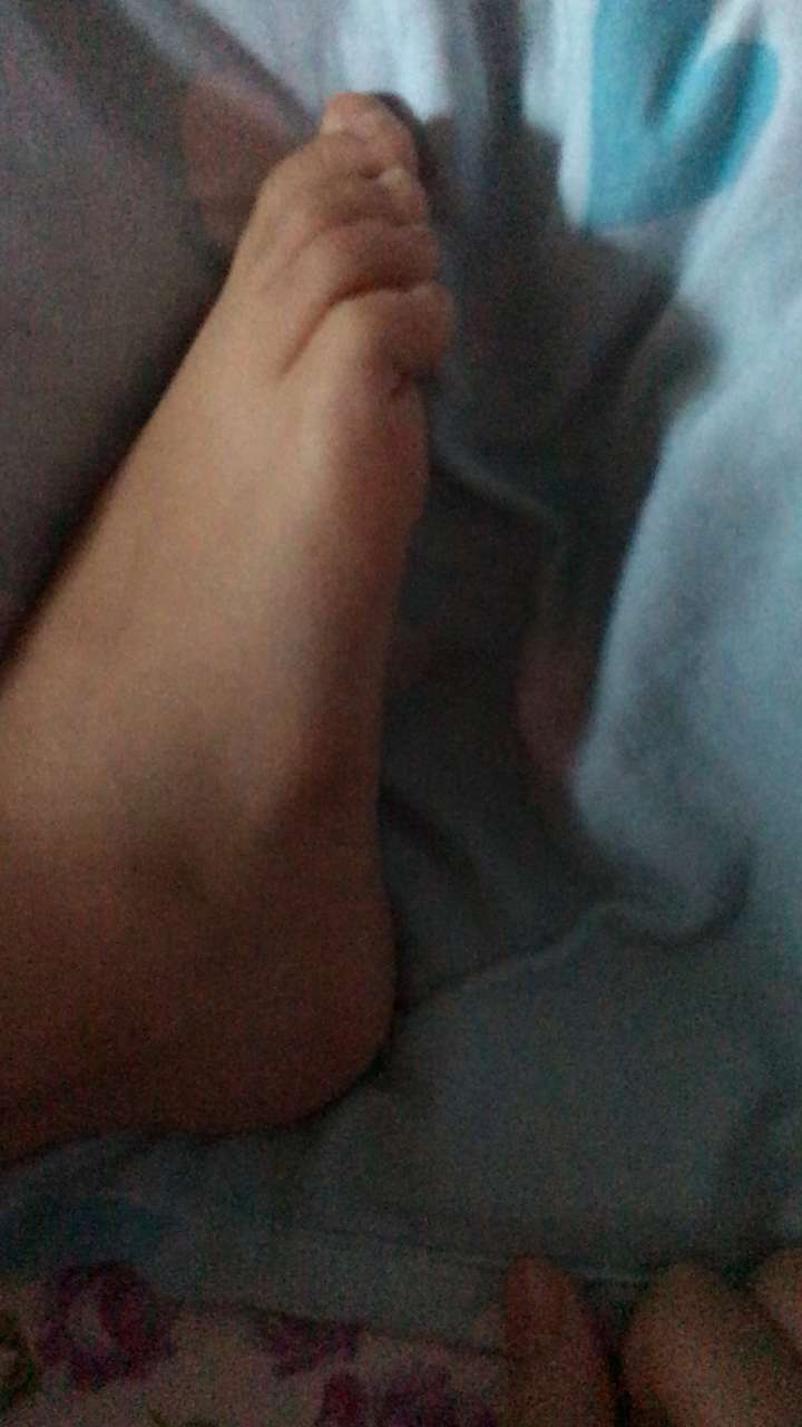 脚侧面的骨头有点突出,有没有学医的朋友帮忙解答一下?