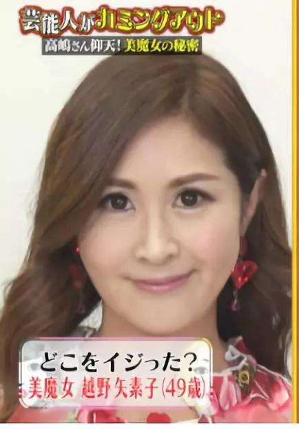 13万做鼻整形效果不满 恢复期过后脱胎换骨然后去当艺人也是赚了 知乎