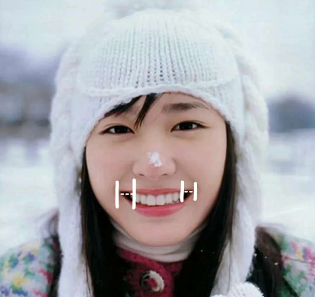 印第安纹剥离研究 的想法: 为什么有人笑起来好看,有人像哭呢?