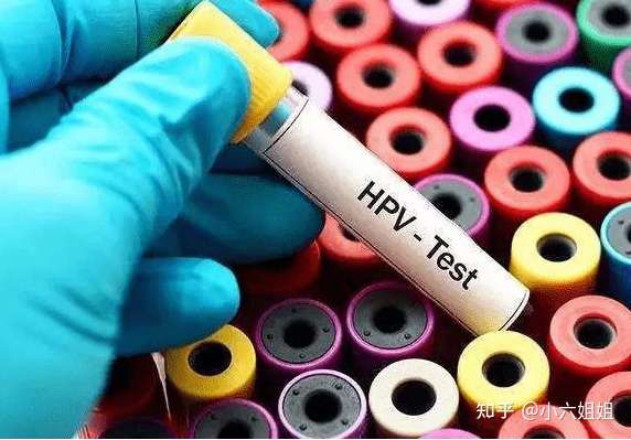 1,感染hpv,就代表行為不潔或者出軌嗎?