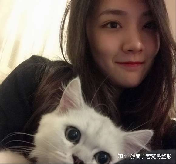 在 南宁奢梵鼻整形专科 做的鼻子 疯狂点赞 知乎