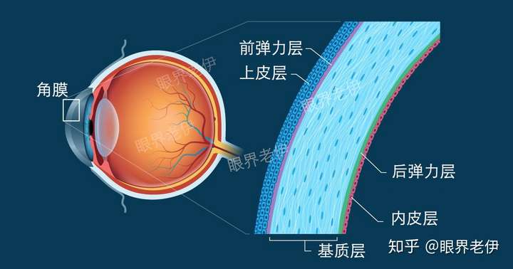 全飞秒和半飞秒得区别该如何选择
