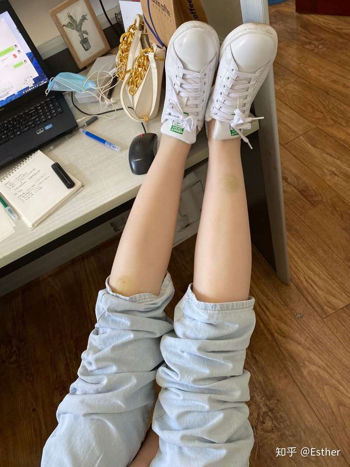 为什么有的女生脚踝很粗?