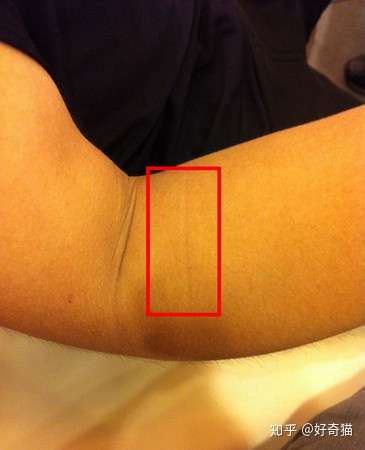 处男线是怎么回事