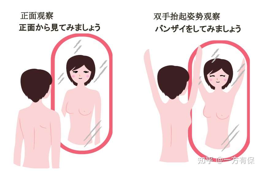 中日医疗培训 乳腺疾病知识科普 知乎