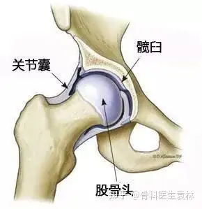 髖關節發育不良長短腿能治好嗎