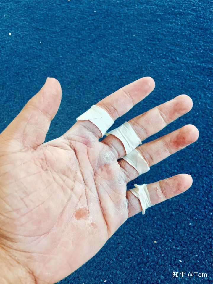 体操运动员的手是什么样?