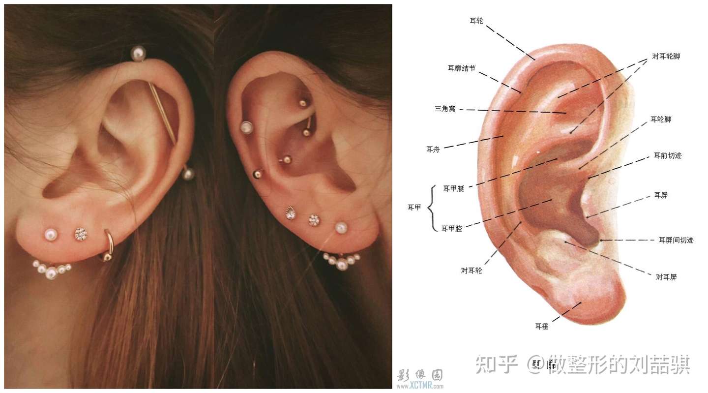 解答 那些年关于 耳软骨切取前后 的耸人传闻 知乎