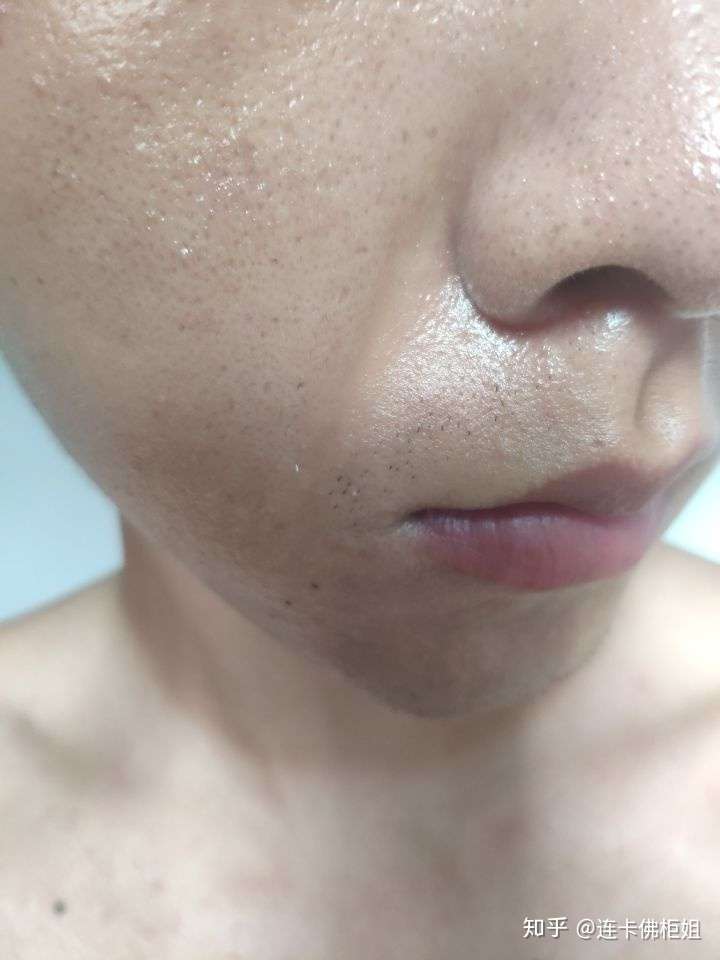 拥有我这种糟心的皮肤该怎么办?