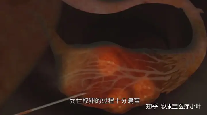 在中国现在做试管婴儿需要多少钱呀（做试管婴儿有多痛，几张3D模拟图，看完全过程后心疼女人）